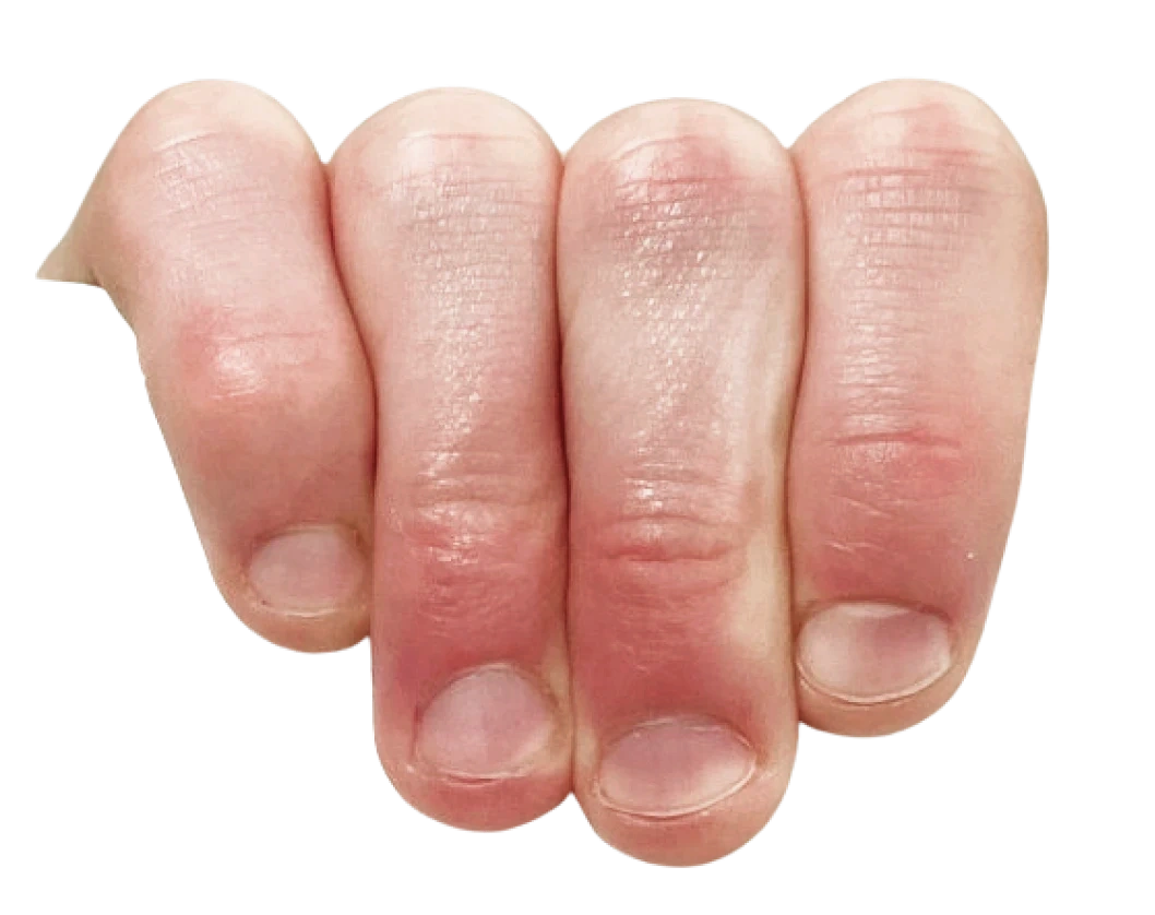 lefthand